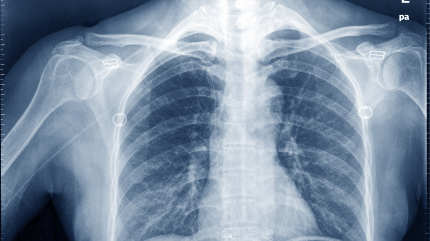 Medicinhistoria – Röntgen genom tiderna